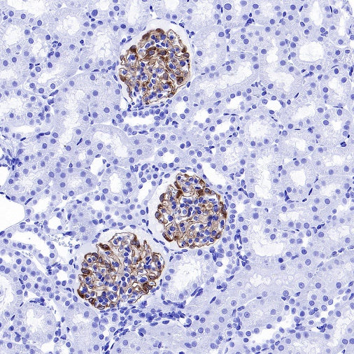NPHS1 Recombinant Rabbit mAb (SDT-2148-63)