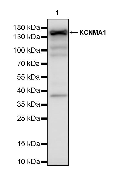 KCNMA1 Recombinant Rabbit mAb (S-2926-33)
