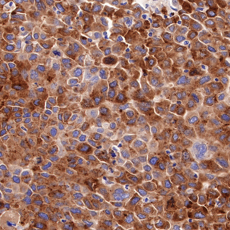 Asialoglycoprotein Receptor 1 Recombinant Rabbit mAb (SDT-292-48)