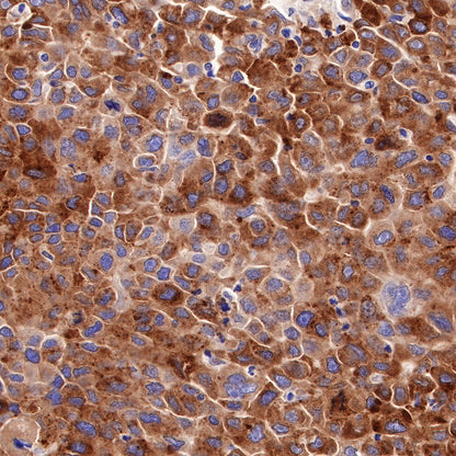 Asialoglycoprotein Receptor 1 Recombinant Rabbit mAb (SDT-292-48)