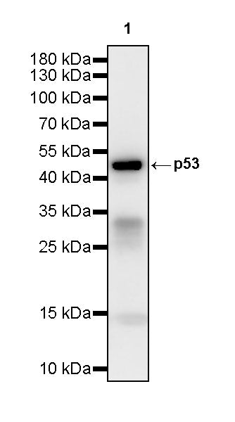 p53 Recombinant Rabbit mAb (S-3975-17)