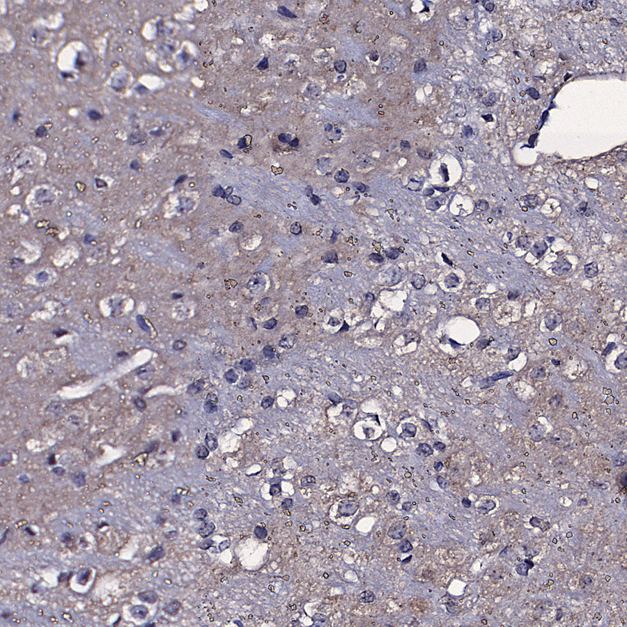 TOM70 Mouse mAb