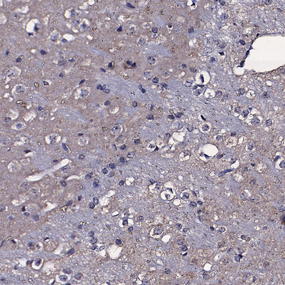 TOM70 Mouse mAb