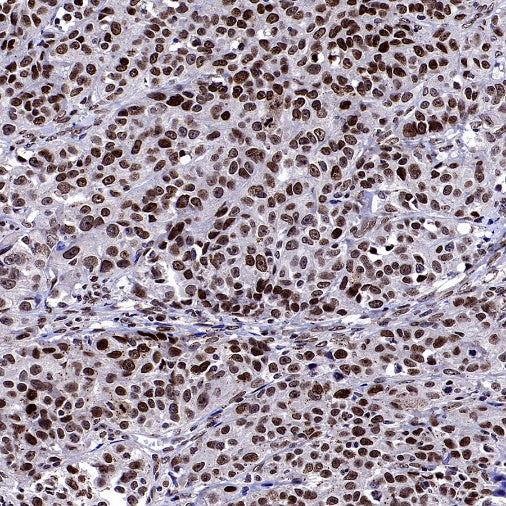 Fibrillarin Recombinant Rabbit mAb (S-1718-171)