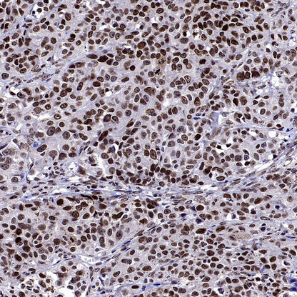 Fibrillarin Recombinant Rabbit mAb (S-1718-171)