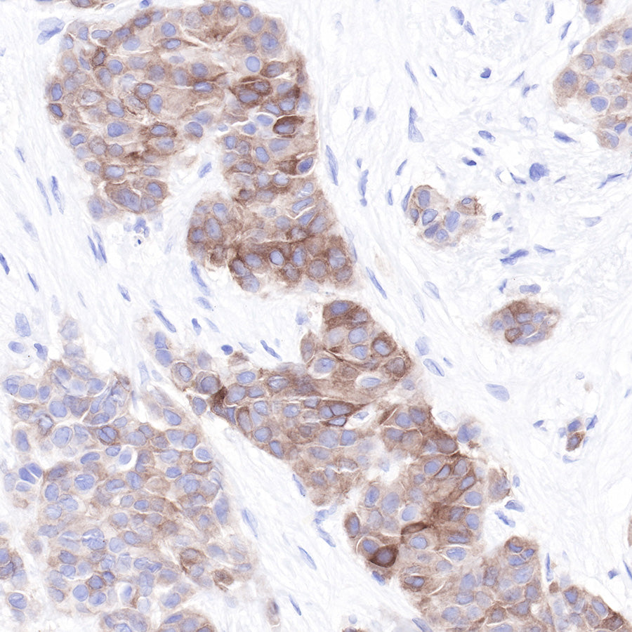 LIV-1/SLC39A6 Recombinant Rabbit mAb (SDT-206-84)