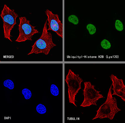 Ubiquityl-Histone H2B (Lys120) Recombinant Rabbit mAb (S-5698)