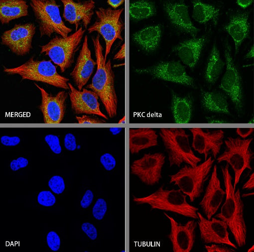 PKC delta Recombinant Rabbit mAb (S-2563-26)