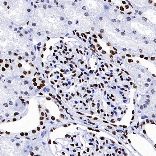 hnRNP H Rabbit Polyclonal Antibody