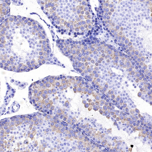 TACC3 Recombinant Rabbit mAb (S-3048-50)
