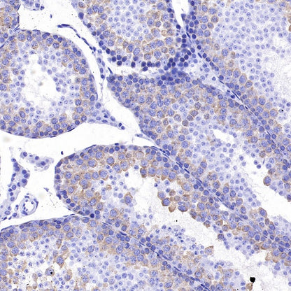 TACC3 Recombinant Rabbit mAb (S-3048-50)