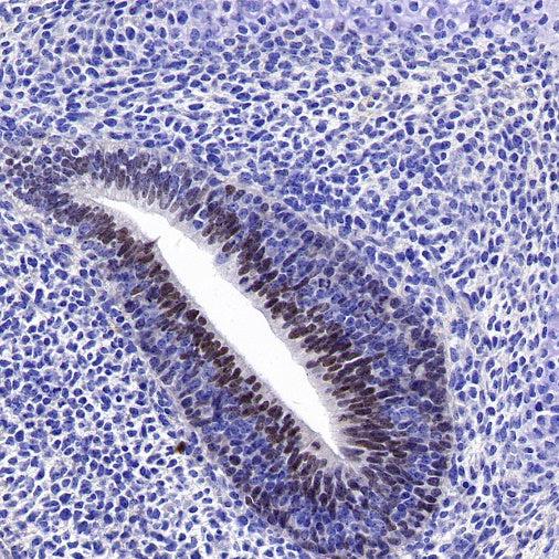 OTX2 Recombinant Rabbit mAb (S-2095-8)