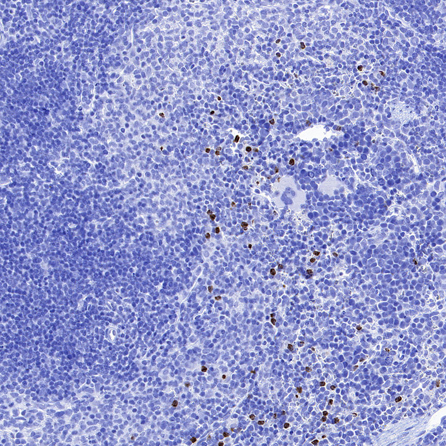 MMP9 Recombinant Rabbit mAb (S-3915-36)