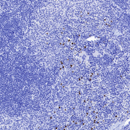 MMP9 Recombinant Rabbit mAb (S-3915-36)