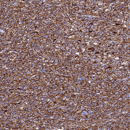 S-RMab® CD20 Recombinant Rabbit mAb,PBS Only (SDT-R133)