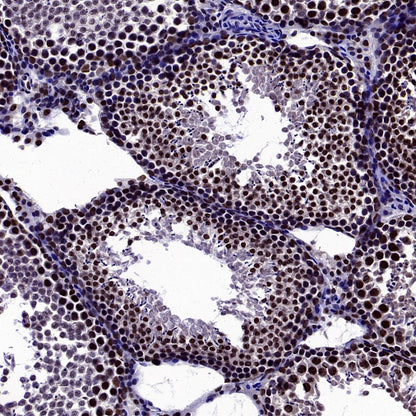 MBD3 Rabbit Polyclonal Antibody