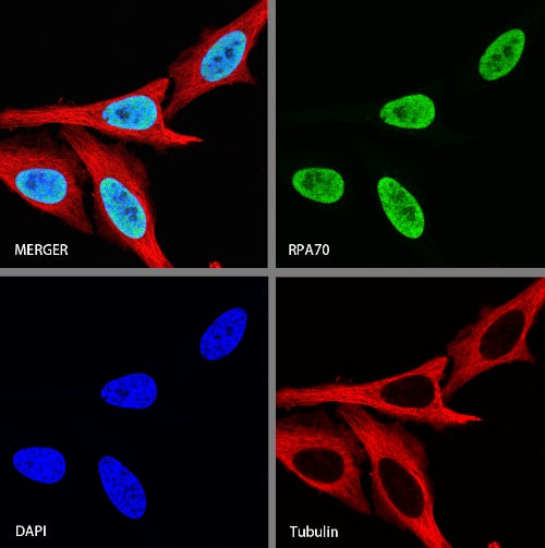 RPA70 Recombinant Rabbit mAb (S-1653-9)