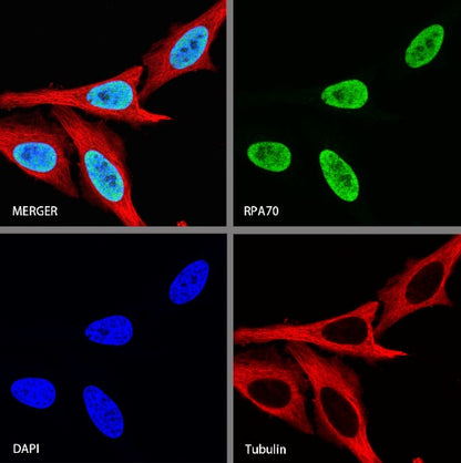RPA70 Recombinant Rabbit mAb (S-1653-9)