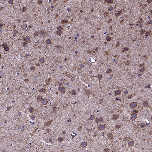 KCNB1 Recombinant Rabbit mAb (S-2527-21)