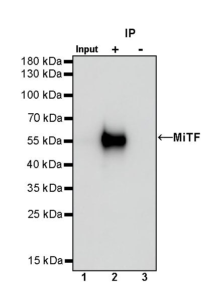 MiTF Recombinant Rabbit mAb (S-1047-50)