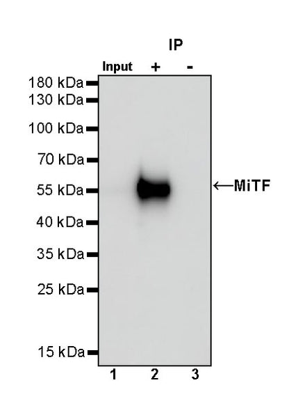 MiTF Recombinant Rabbit mAb (S-1047-50)
