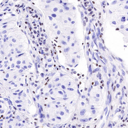 IKAROS Recombinant Rabbit mAb (S-R264)