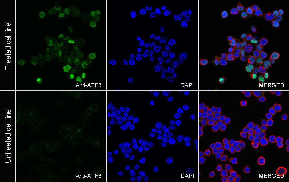 ATF3 Recombinant Rabbit mAb (S-3904)
