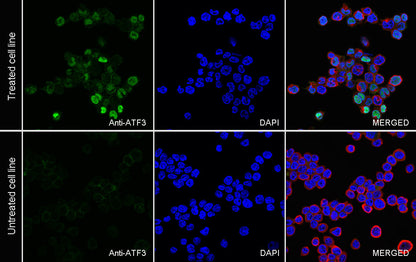 ATF3 Recombinant Rabbit mAb (S-3904)
