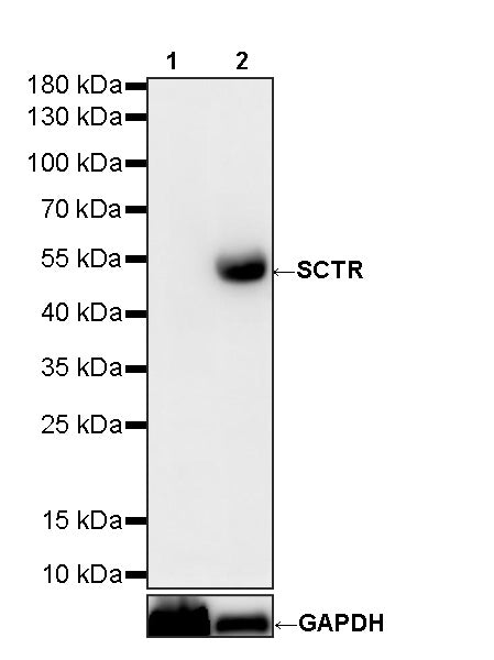 SCTR Recombinant Rabbit mAb (S-3949-52)