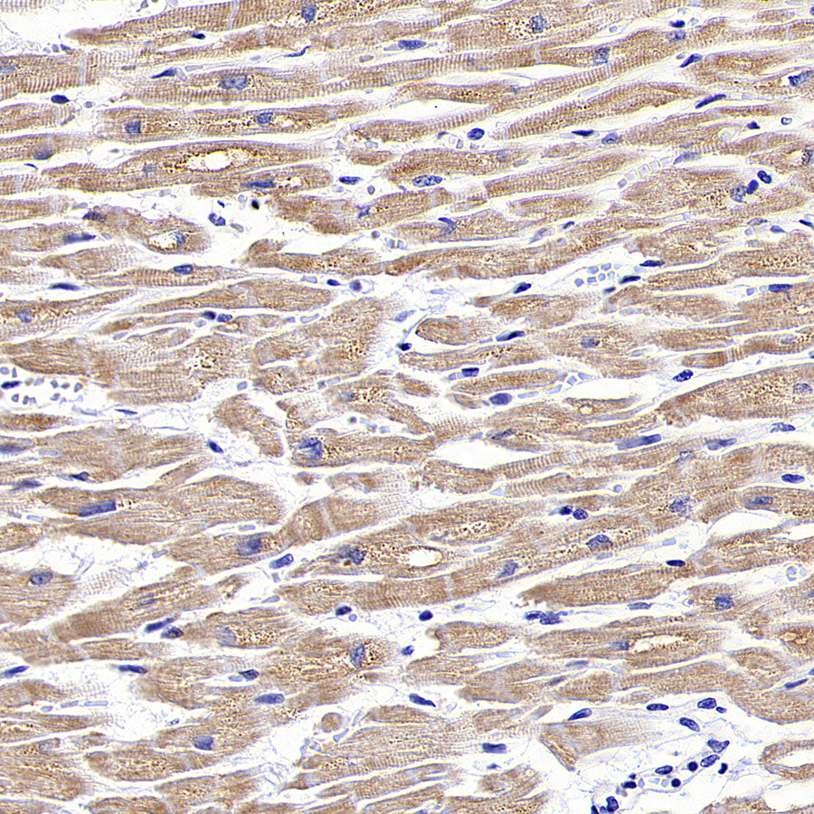 NDUFB8 Recombinant Mouse mAb (S-M0007)
