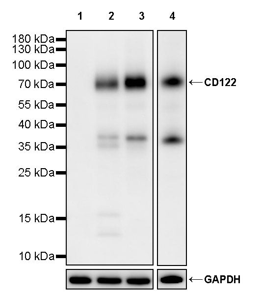 CD122 Recombinant Rabbit mAb (S-3364-9)