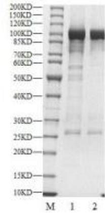 PKCβ1 GST Tag Protein, Human