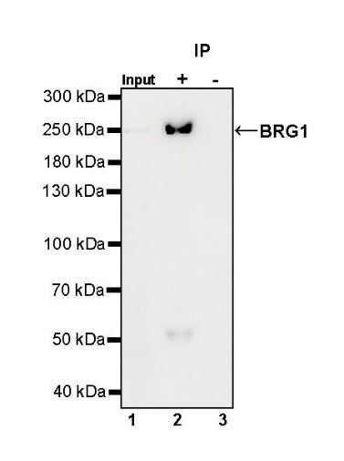 BRG1 Recombinant Rabbit mAb (S-1513-4)