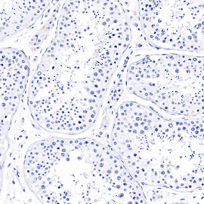 PAPP-A Recombinant Rabbit mAb (SDT-226-46)