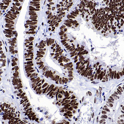 RIBEYE/CTBP2 Rabbit Polyclonal Antibody