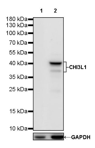 CHI3L1 Recombinant Rabbit mAb (S-324-38)