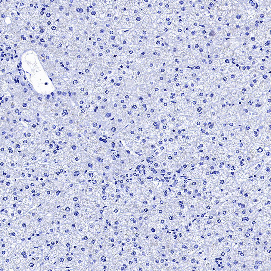 Glypican-3 Recombinant Rabbit mAb (SDT-4064-69)