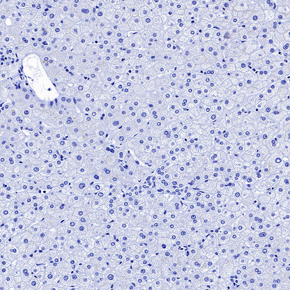 Glypican-3 Recombinant Rabbit mAb (SDT-4064-69)