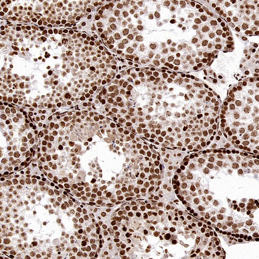 FOXM1 Recombinant Rabbit mAb (S-2529-26)