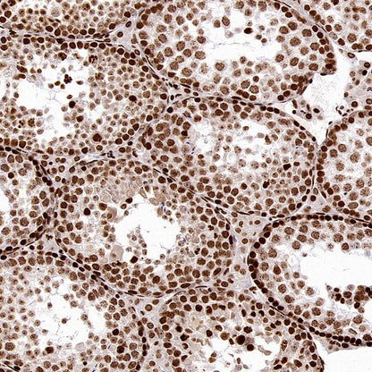 FOXM1 Recombinant Rabbit mAb (S-2529-26)