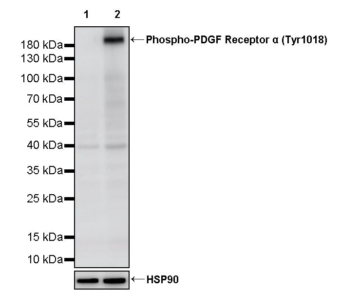 Phospho-PDGF Receptor α (Tyr1018) Recombinant Rabbit mAb (S-3482-7)