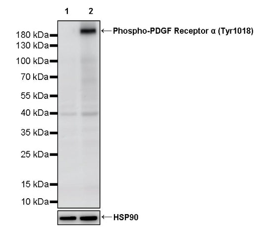 Phospho-PDGF Receptor α (Tyr1018) Recombinant Rabbit mAb (S-3482-7)