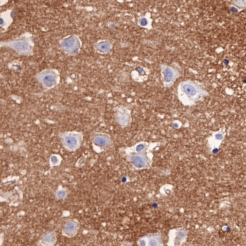 Tissue factor Recombinant Rabbit mAb (S-893-34)