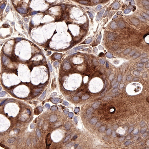 COX2 Recombinant Rabbit mAb (S-870-18)