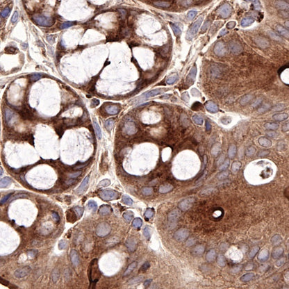 COX2 Recombinant Rabbit mAb (S-870-18)