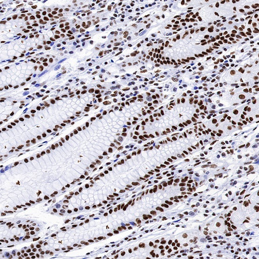 TAF15 Recombinant Rabbit mAb (S-1508-53)