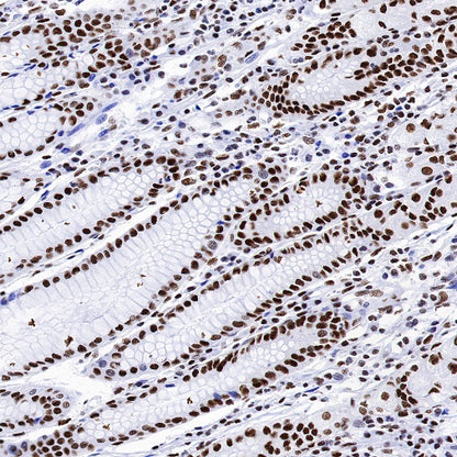 TAF15 Recombinant Rabbit mAb (S-1508-53)