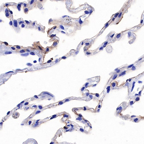 Human folate receptor alpha Recombinant Rabbit mAb (SDT-719-20-2)