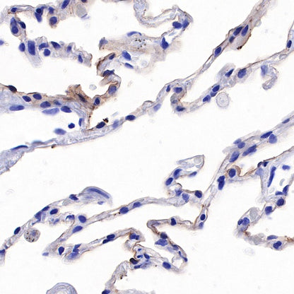 Human folate receptor alpha Recombinant Rabbit mAb (SDT-719-20-2)