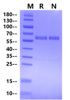 NEK7 GST Tag Protein, Human